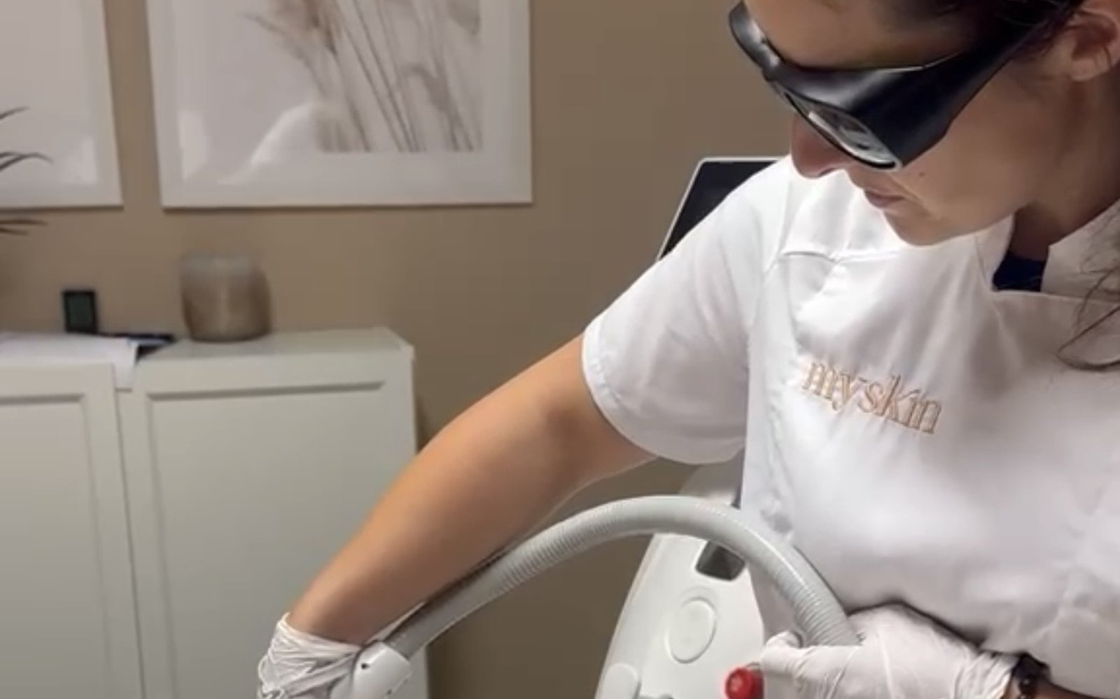 Séance d'épilation laser à l'institut mySkin Delémont