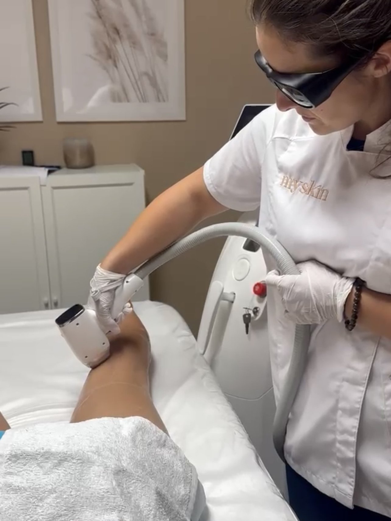 Épilation laser à l'institut mySkin Delémont